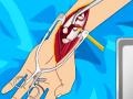 Xogo Arm surgery 2
