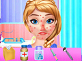 Xogo Anna Spring Allergy Treatment