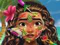 Xogo Moana Skin Doctor