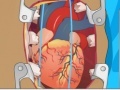 Xogo Heart Surgery