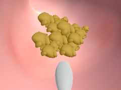 Xogo Earwax Clinic