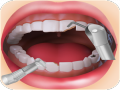 xogos do dentista 